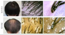 -章光101防脱养发荟