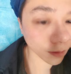 -针美汇欧邦医疗美容