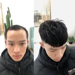 -发饰美男士增发补发假发定制店