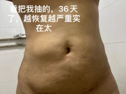-深圳艺星医疗美容医院