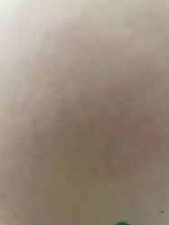 -美瑞莎创美医疗美容