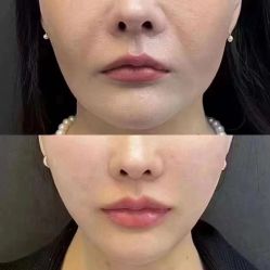 -郡艺医疗美容·微整·眼鼻吸脂