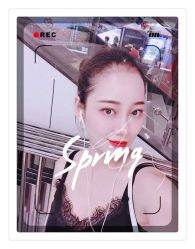 体验后-大麦微针植发全国连锁