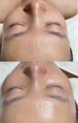 -美愈美肤MEIYU SKIN