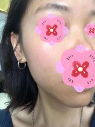 体验后-Boss H Beauty美肌中心