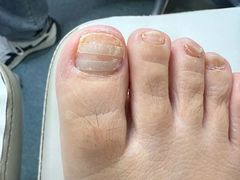 -新甲连锁灰指甲·甲沟炎·鸡眼(黑龙江路店)