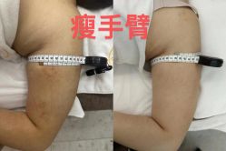 -Lily纤美·科技减脂中心