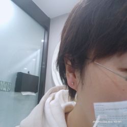 体验后-洁铭新加坡医美