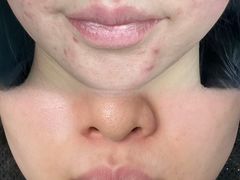 -上置·美兰优湖