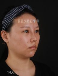 -北京米扬丽格医疗美容·联合丽格鼻整形中心