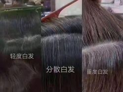-希梵尔头皮抗衰·科技养发