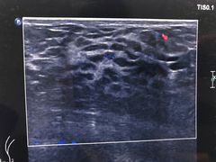 -天津市人民医院-停车场