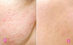 -SKINIST丽铂医疗美容