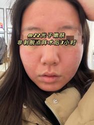 -叶美人医疗美容