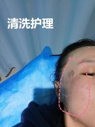 -长沙雅美医疗美容医院