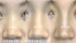 点击看大图 -西施无菌半永久纹绣眉眼影唇轻增发纹发际线