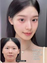 点击看大图 -Yestar艺星医疗美容医院