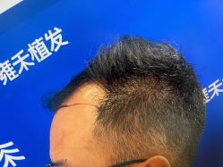 -雍禾植发全国连锁