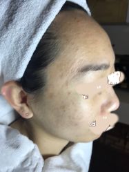 -皇族养心堂·净痘·修敏·御颜