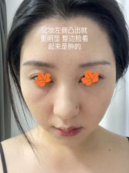 点击看大图 -美莱医疗美容医院