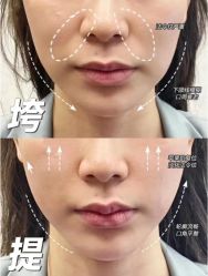 -克丽缇娜