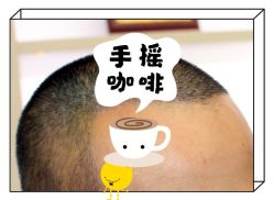 -大麦微针植发全国连锁