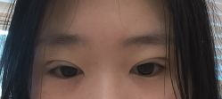 体验后-上海首尔丽格医疗美容医院