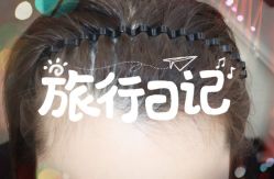 -大麦微针植发全国连锁