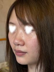 -Yestar重庆艺星医疗美容医院