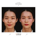 玻尿酸的功效真是太强大了！！