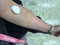 -北京大学肿瘤医院