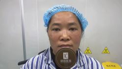体验后-广州健丽·去眼袋医疗美容机构