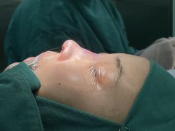 -北京米扬丽格医疗美容·联合丽格鼻整形中心