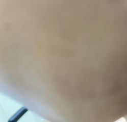 -美莱医疗美容医院