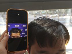 -碧莲盛·不剃发植发