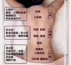-苗塑堂减肥艾灸