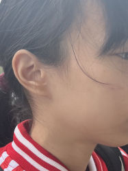 -清疣美疣·痣·斑净肤中心