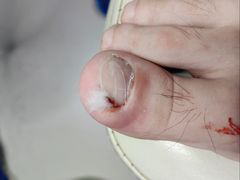 -新甲连锁灰指甲·甲沟炎·鸡眼(黑龙江路店)