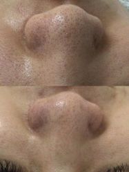 -FUMEIHUI·科技美肤·美体SPA