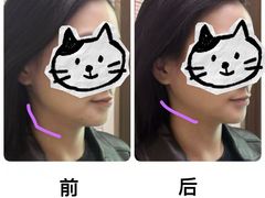 -修申骨雕小颜脊柱骨盆管理产后修复