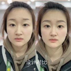 点击看大图 -Verywang半永久纹眉•仪器野生眉