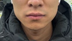 -河南京城皮肤美容医院