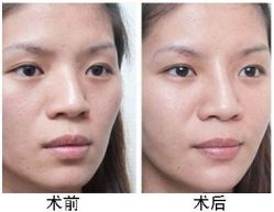 -CMS西美斯·美式医疗美容