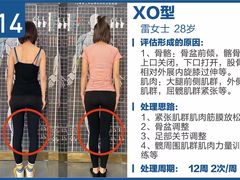 -体博士·疼痛调理·体态矫正·运动康复中心(大望路华贸店)