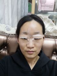 体验后-西安壹加壹医疗美容·西北抗衰旗舰店
