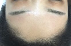 -郡艺医疗美容·微整·眼鼻吸脂