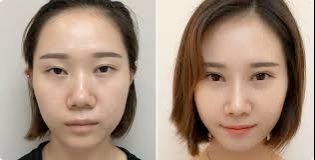 -SKINIST丽铂医疗美容