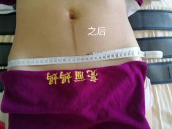 -亮丽妈妈·催乳通乳·产后恢复(万达店)