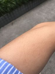 -上海玫瑰医疗美容医院