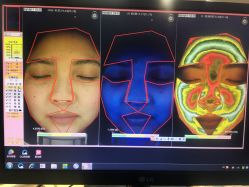 皮肤检测-光SPA科技美肤